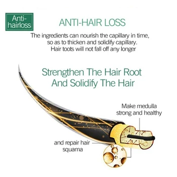 30 ML Zencefil Kral Saç Bakımı uçucu yağ Ferahlatıcı ve Besleyici Saç Derisi Saç Folikülü Besin Çözüm Saç Kalitesini Artırmak için
